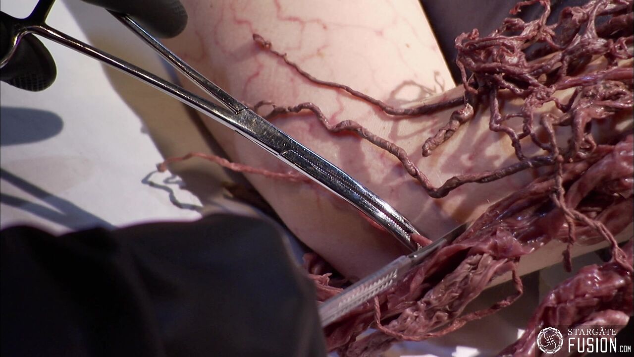 Contamination