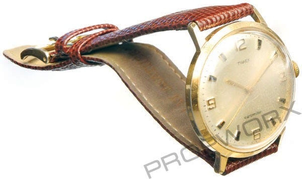 Montre + Lunettes de Weir