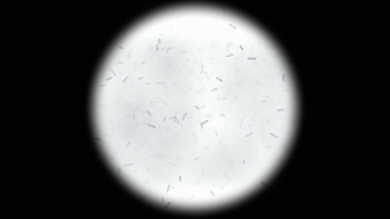 Micro-organismes des glaces