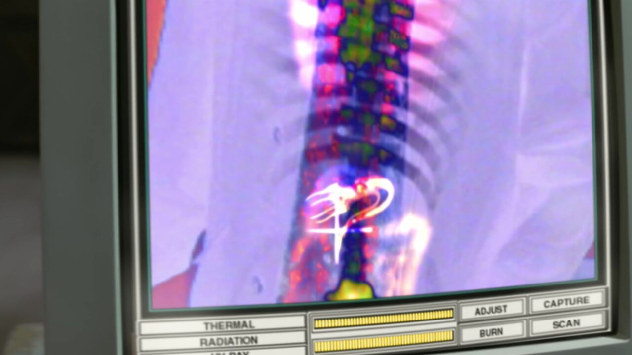 Thermoscan
